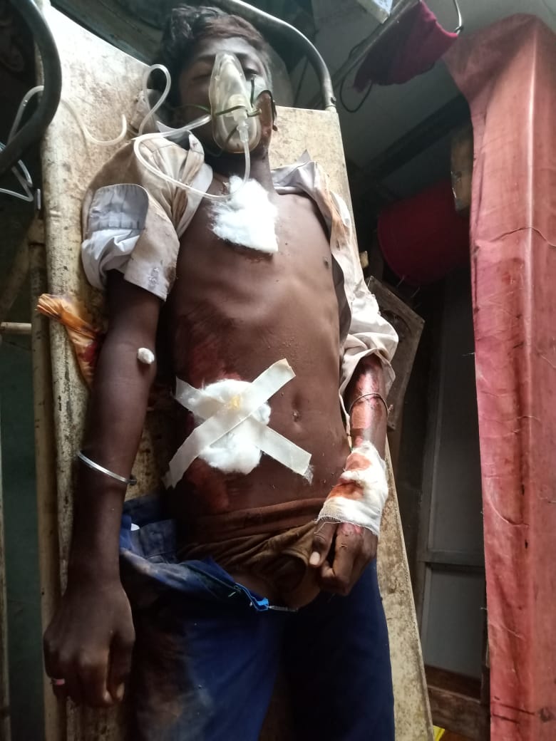 नन्दिनी थाना क्षेत्र में कक्षा 9वीं के छात्र की सड़क हादसे में दर्दनाक मौत