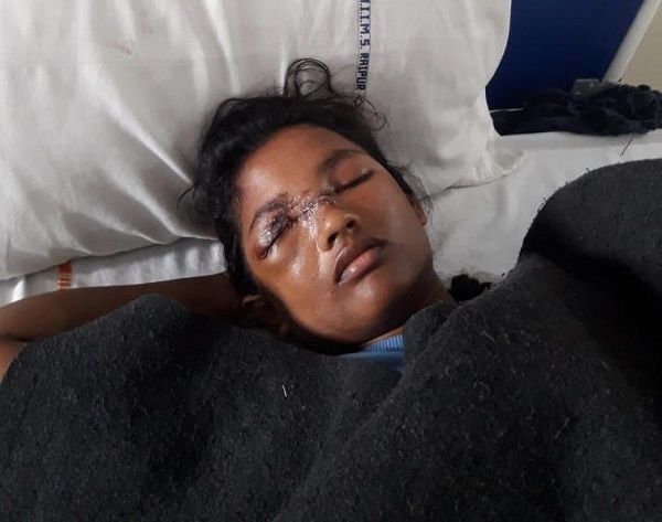 वैशाली की जिंदगी में उजाला लाने सीएम ने सहायता कोष दिए दो लाख, मेयर देवेंद्र ने लिखा था पत्र