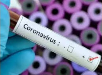 आज दुर्ग जिले में मिले 199 कोविड पॉजिटिव मामले.....